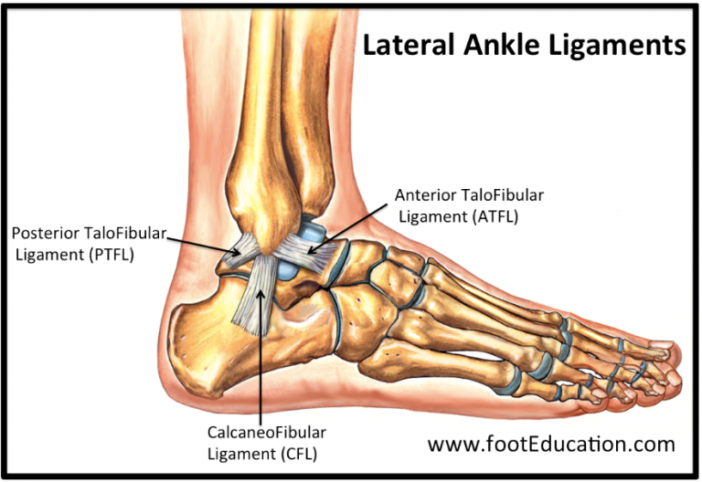 ankle-sprains-healing-times-why-rest-is-not-the-answer